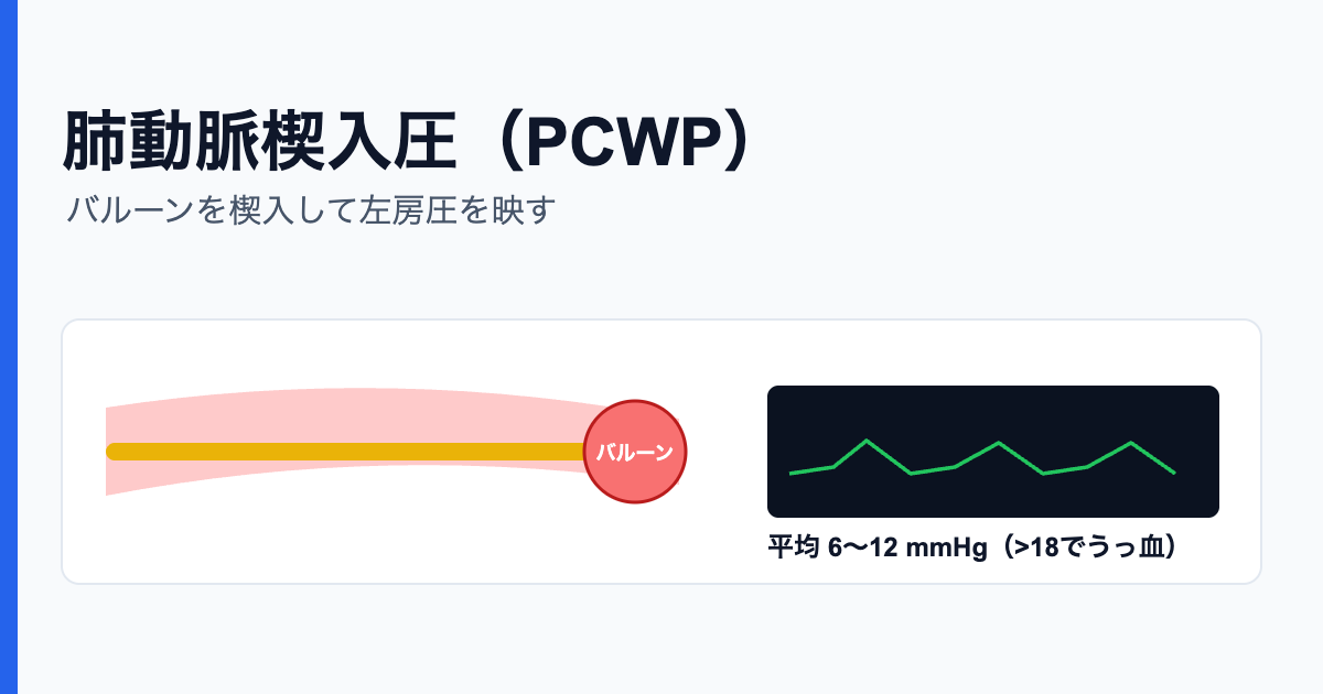肺動脈楔入圧 PCWP バルーン楔入