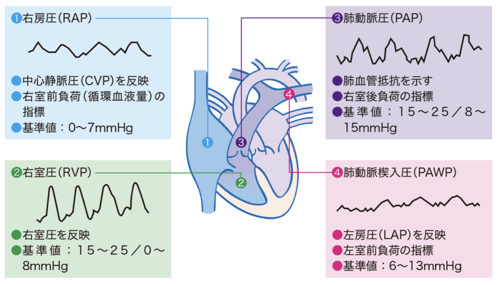 右心筋症の治療