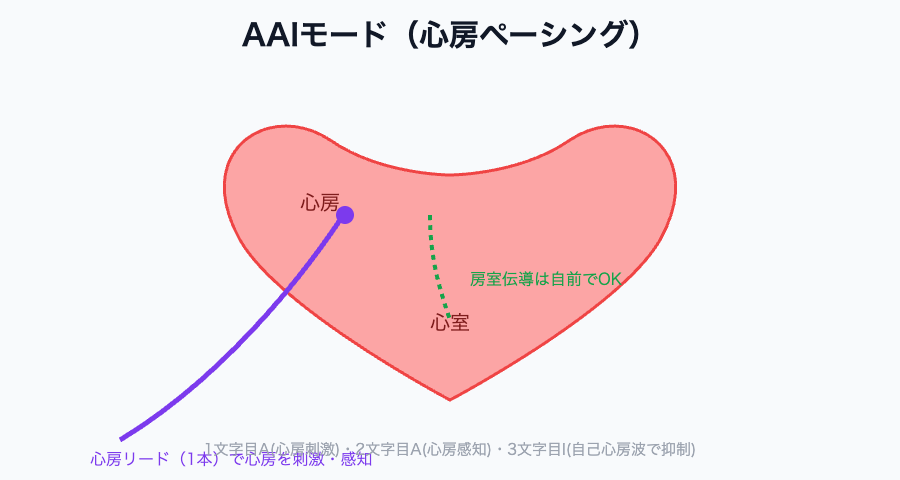 AAIモード：心房リードのみで心房を刺激・感知し、房室伝導は自前