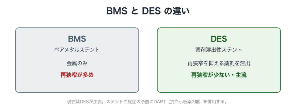 BMSとDESの違い