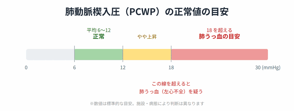 肺動脈楔入圧PCWPの正常値:平均6〜12mmHg、18を超えると肺うっ血の目安