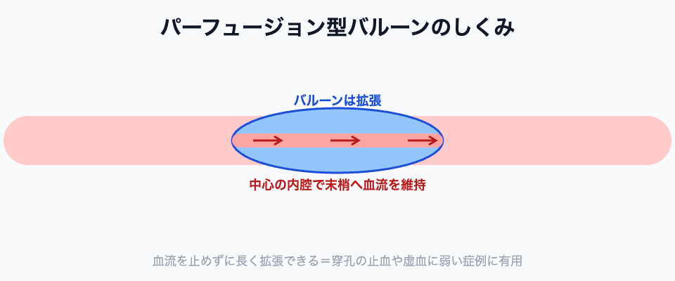 パーフュージョン型バルーンのしくみ（血流を維持しながら拡張）