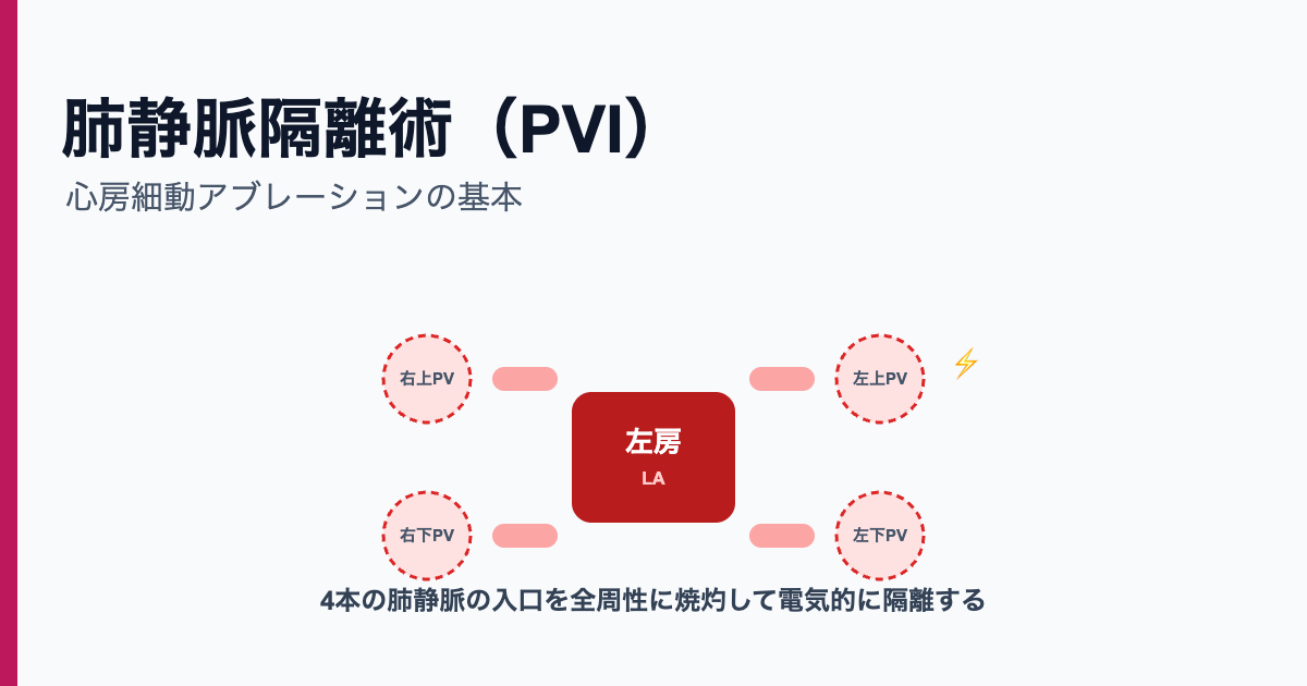 肺静脈隔離術PVIの概念図