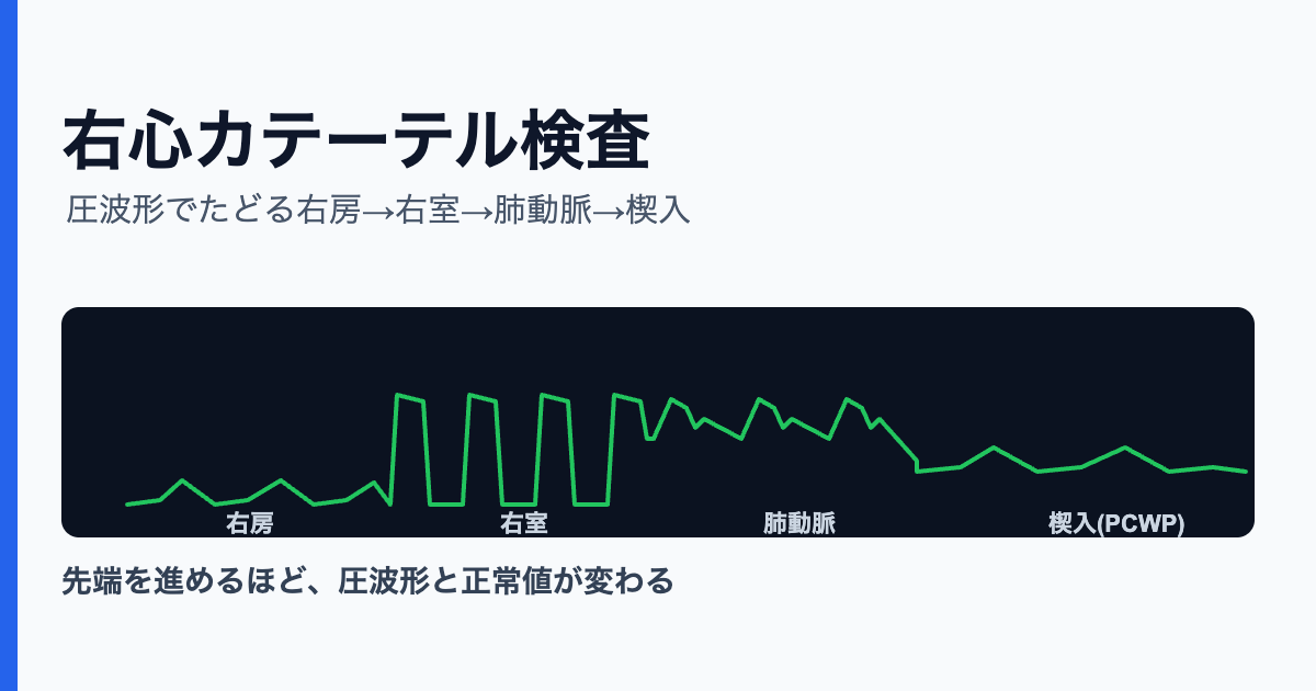 右心カテーテル検査とは｜目的・測定項目（圧・心拍出量・SvO₂）・正常