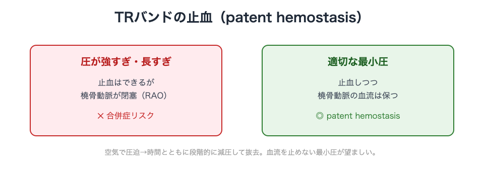 TRバンド：適切な最小圧で血流を保ちつつ止血（patent hemostasis）