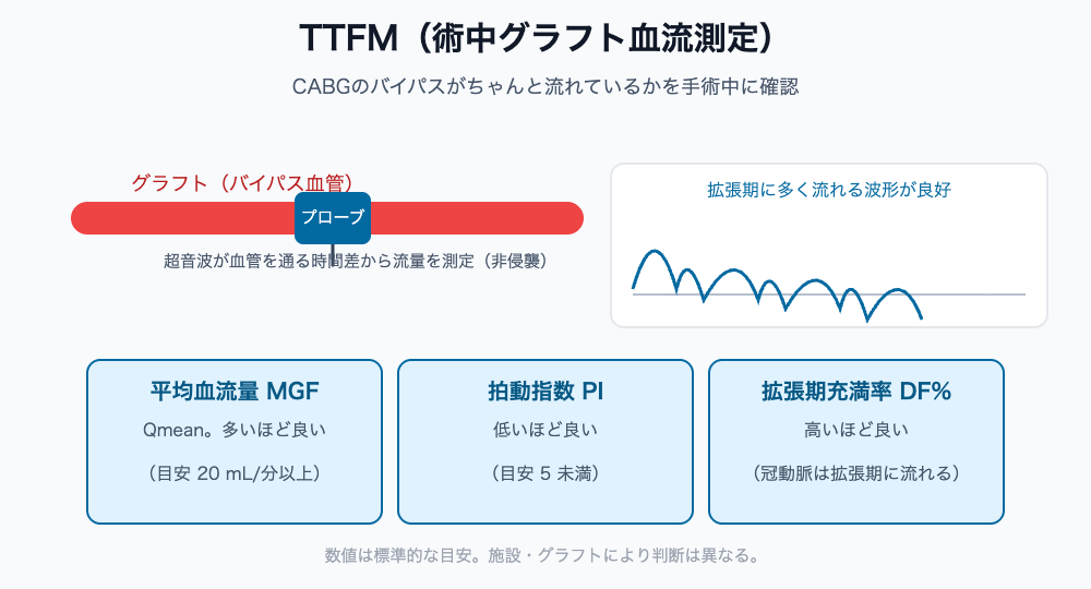 TTFMのしくみと主な指標（平均血流量MGF・拍動指数PI・拡張期充満率DF%）